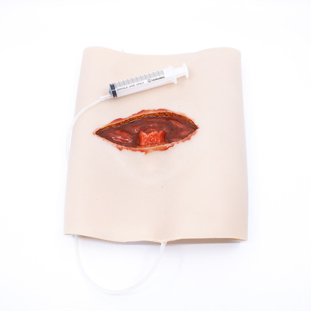 TRAUMASIM Wearable Open Femur Fracture โ Upper Leg โ w/ Bleeding Capacity