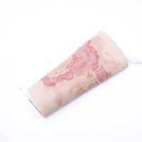 TRAUMASIM Wearable Large Burn – Upper Leg